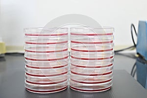 Petri dishes filled with colorful agar growth medium. Medical science equipment