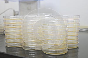 Petri dishes filled with colorful agar growth medium. Medical science equipment