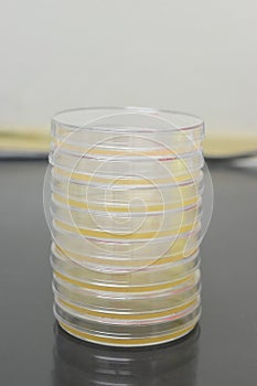 Petri dishes filled with colorful agar growth medium. Medical science equipment