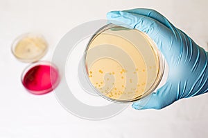 Petri dishes with growing bacteria in medical laboratory