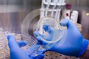 Petri dishes with transgenic bacteria. Photo taken from laminar interior