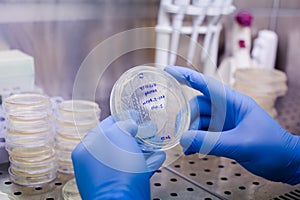 Petri dishes with transgenic bacteria. Photo taken from laminar interior