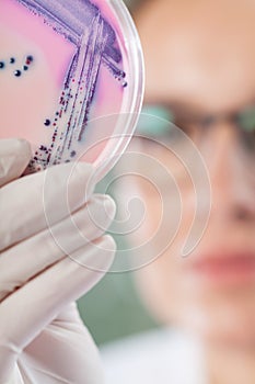 Petri plate with microbacteria