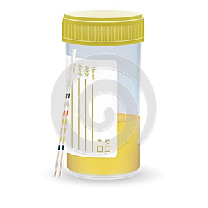 Ph Test Strips, Litmus Paper And Urine In Test Jar On A White Background. Realistic Vector Illustration.