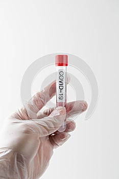 COVID-19 Pandemic COVID-19 Vaccination test for Corona virus patients