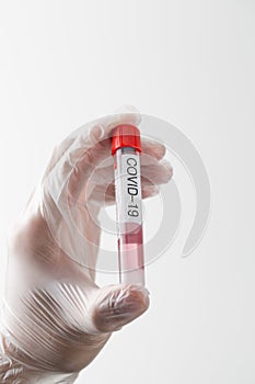 COVID-19 Pandemic COVID-19 Vaccination test for Corona virus patients
