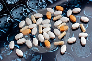 Pharmaceutical medicine pills on magnetic brain resonance scan mri background. Pharmacy theme, health care
