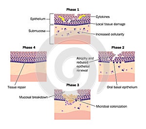 Phases of epithelial repair