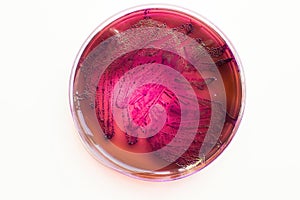 phenotypic traits of Escherichia coli bacteria on selective media photo