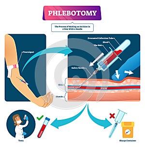Phlebotomy vector illustration. Labeled veins blood samples process scheme.