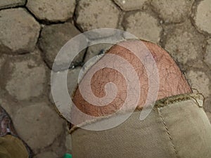 Photo of a boy\'s leg wearing torn brown trousers against a hexagonal brick floor in the background