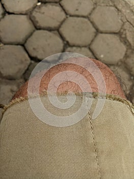 Photo of a boy\'s leg wearing torn brown trousers against a hexagonal brick floor in the background