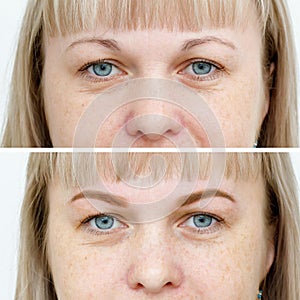 Photo comparison before and after permanent makeup, tattooing of eyebrows