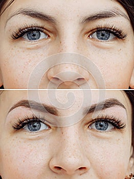 Photo comparison before and after permanent makeup, tattooing of eyebrows