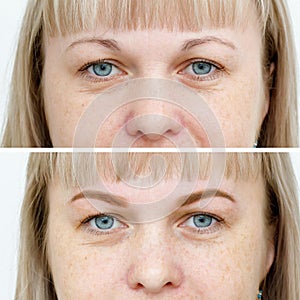 Photo comparison before and after permanent makeup, tattooing of eyebrows photo