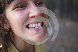 Photo of crooked woman teeth