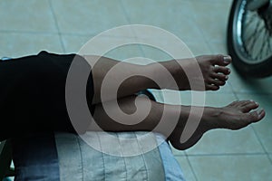 Photo of the human foot, version 3