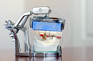 Photo of a Mold - Dental Concept
