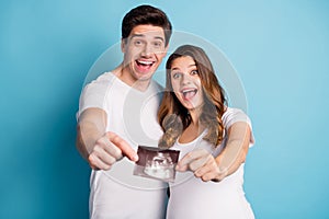 Photo portrait two people happy husband pregnant wife holding belly ultrasound screening photo isolated vibrant blue