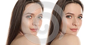 Photo before and after retouch. Portrait of beautiful young woman on white background, banner design