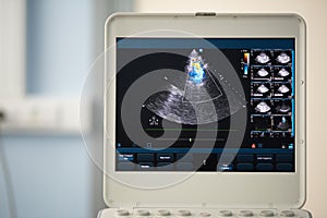 Photo of the screen of an ultrasound scanner with the image of a