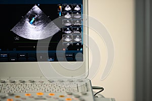 Photo of the screen of an ultrasound scanner with the image of a