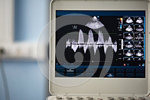 Photo screen ultrasound scanner with a picture of the heart scan