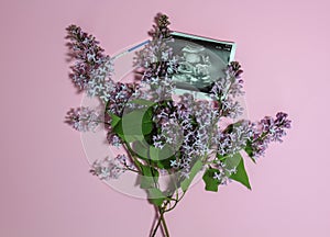 Photo ultrasound of a pregnant fetus on a background of a bouquet of lilacs