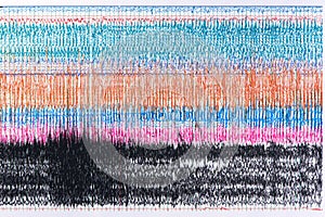 Photograph of brain waves during seizure