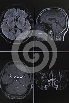 Photography of human brain magnetic resonance imaging