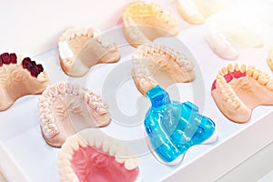 Photopolymer resin printed gum mask teeth