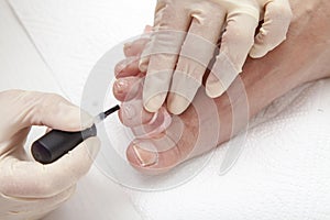 Photos of foot nail varnishing process, series of photos