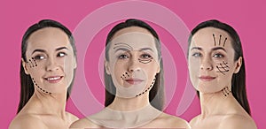 Photos of mature woman with lifting marks on face against background, collage. Cosmetic surgery