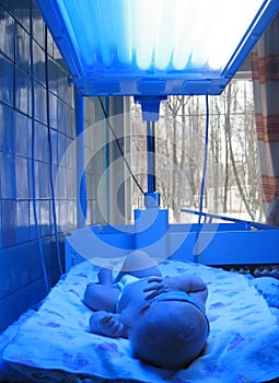 Phototherapy for newborn