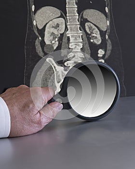 Physcian inspecting a tomograph with a magnifing glass