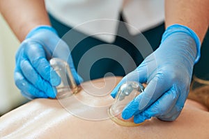 Physical cupping therapy. Doctor performing massage on human body with plastic cups