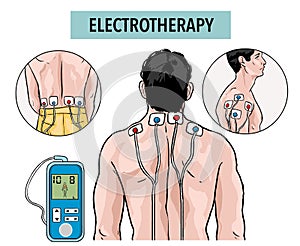 Physical therapy services. Back pain relief. Injury rehabilitation. Electrotherapy