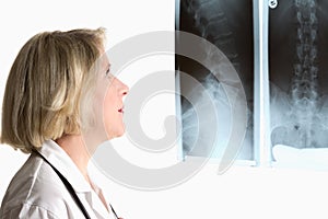 Physician with spine x-rays