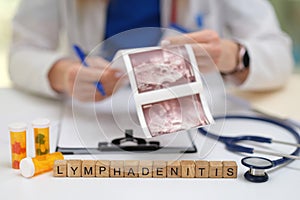 Overview of lymphadenitis diagnosis, treatment protocols, examination methods, and therapies photo