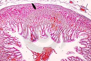 Physiology of the stomach for education in laboratory.