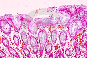 Physiology of the stomach for education in laboratory.