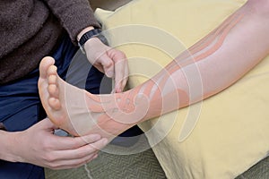 Physiotherapist applying kinesiology tapes photo