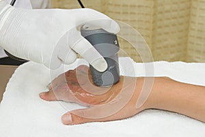 Physiotherapist is applying ultrasound therapy