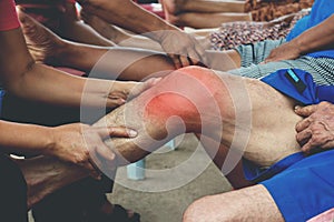 Physiotherapist doing healing on patient knee pain