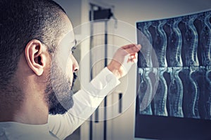 Physiotherapist Looking at X-Ray Film of Spine