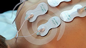 Physiotherapy. Electrotherapy and myostimulation of the back muscles. Physiotherapy treatment for rehabilitation.