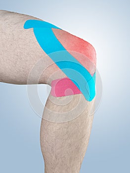 Physiotherapy for knee pain, aches and tension