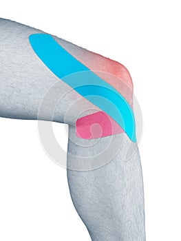 Physiotherapy for knee pain, aches and tension photo
