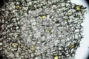 Pickled ginger root under the light microscope photo
