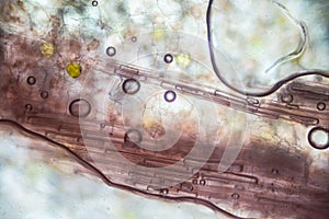 Pickled ginger root under the light microscope photo